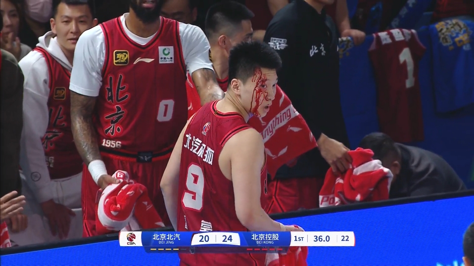 直播吧：雷蒙眼角部位缝了10针 球员表示不影响周三继续出战