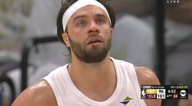 很激烈！马瑟林贴防击中斯特鲁斯致其出血 自己也吃到技犯